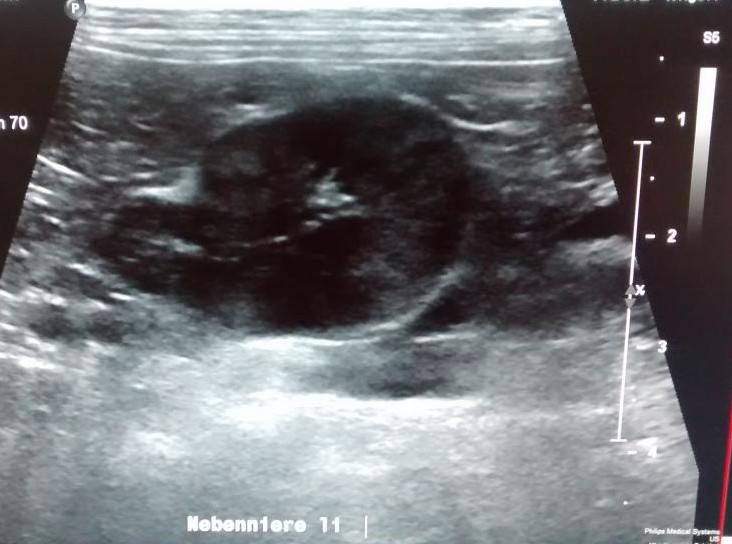 Nebennieren Cushing Coon-Syndrom Ultraschall Katze